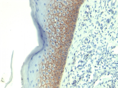 FFPE human skin sections stained with 100 ul anti-E-Cadherin / CD324 (clone CDH1/1525) at 1:100. HIER epitope retrieval prior to staining was performed in 10mM Citrate, pH 6.0.